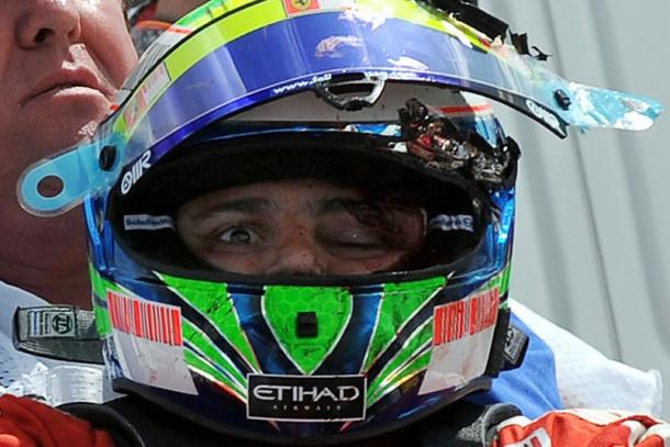 Massa's injury after his 2009 crash was gruesome | Photo: jalopnik.com