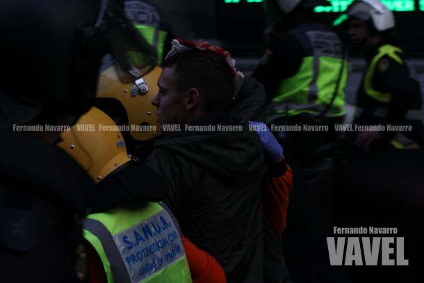 Aficionado polaco herido durante los enfrentamientos. | FOTO: Fernando Navarro - VAVEL España