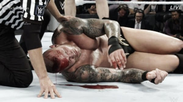 Randy Orton is now medically cleared following his SummerSlam injury (image: sportskeeda.com)