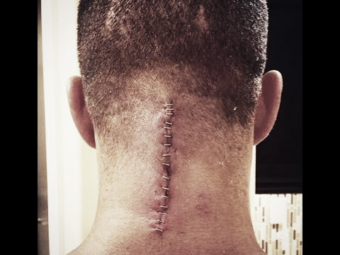 Kidd's injury was horrific. Photo- YouTube.com