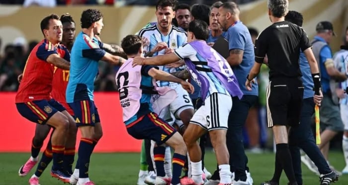 Mano durísima contra la Scaloneta