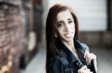 Lizzie Velasquez, el arte de definirse a sí mismo