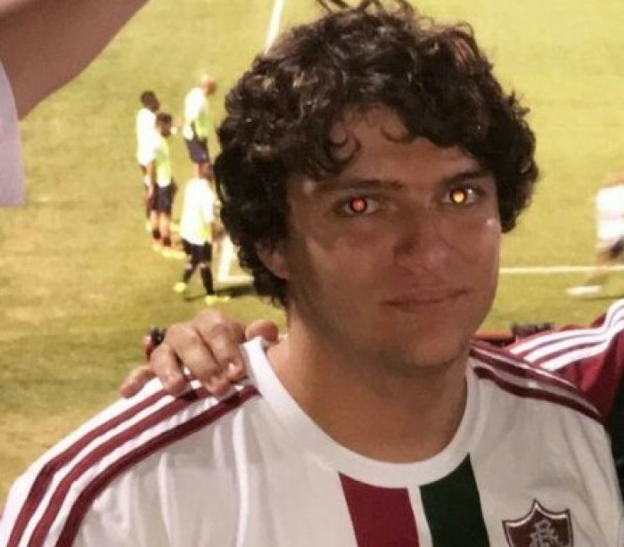 Torcedor do Fluminense é agredido e sofre traumatismo craniano; veja como doar sangue